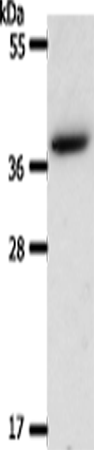 AKR1B1