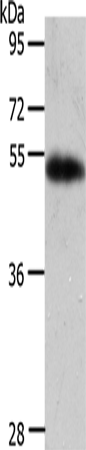 AGT/Angiotensin-1