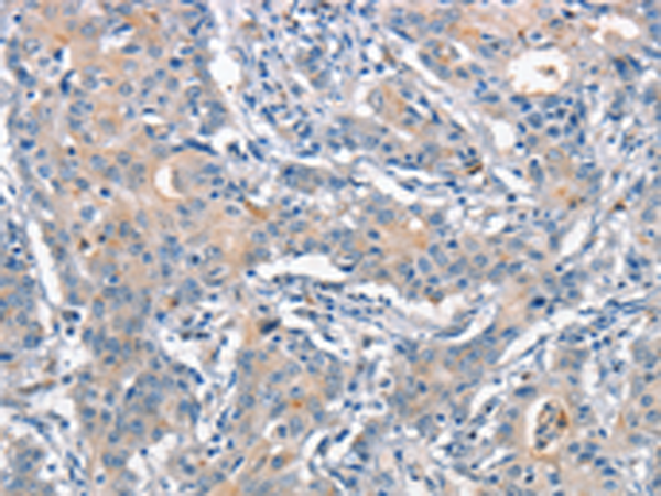 ANAPC1