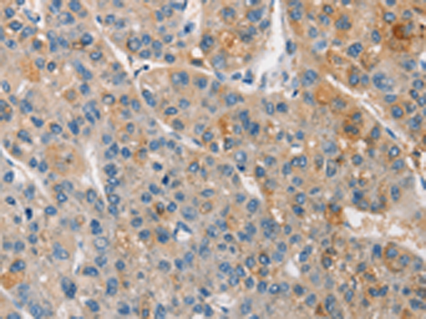APOA5