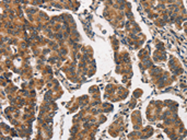 Rabbit Polyclonal Antibody to ITGA2