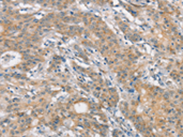 Rabbit Polyclonal Antibody to FZD1