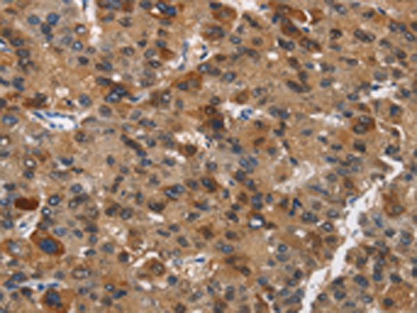 Rabbit Polyclonal Antibody to DCC