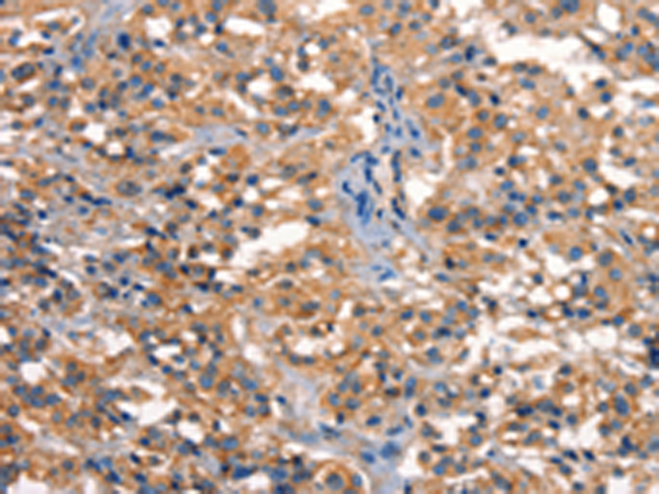 Rabbit Polyclonal Antibody to DCLK1