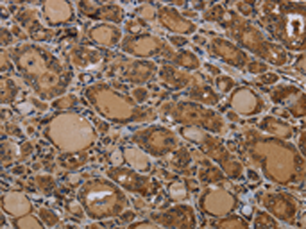 Rabbit Polyclonal Antibody to GJB4