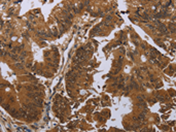 Rabbit Polyclonal Antibody to GJB4