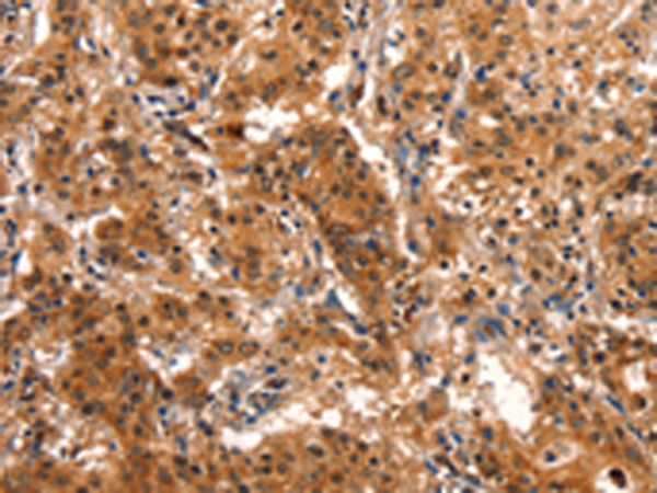 Rabbit Polyclonal Antibody to GJA8
