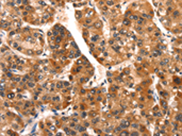 Rabbit Polyclonal Antibody to SMURF2