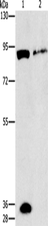 PRKG2