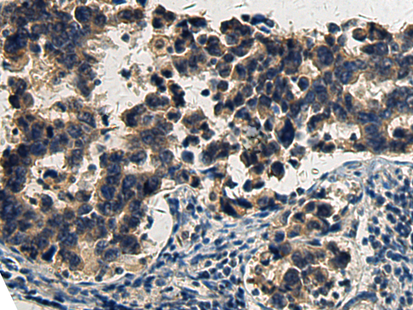 BOK(BH3 domain)
