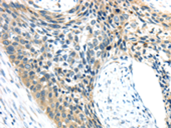 AEBP1