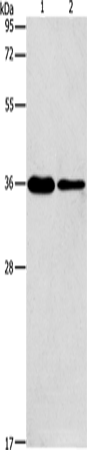 AIMP2