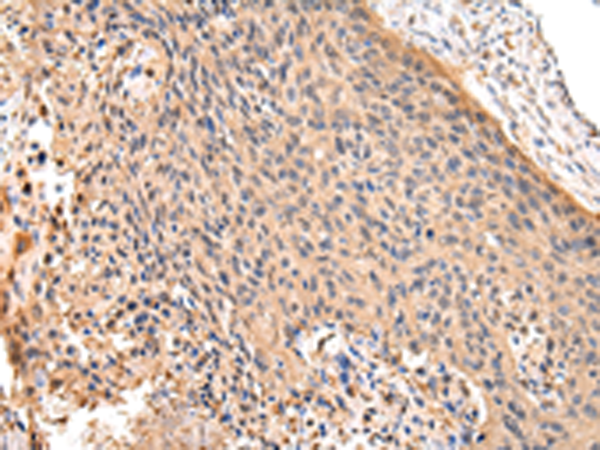Rabbit Polyclonal Antibody to RERE