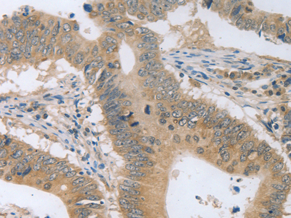 Rabbit Polyclonal Antibody to P2RY11