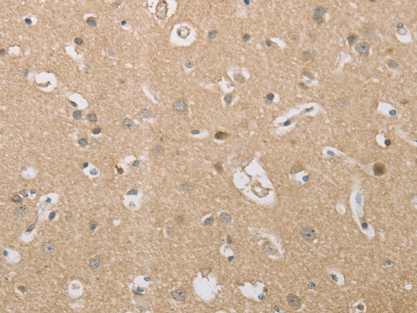 Rabbit Polyclonal Antibody to P2RY11
