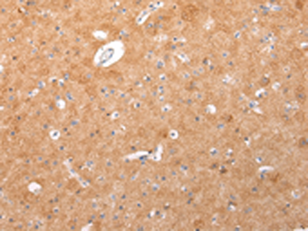Rabbit Polyclonal Antibody to Lambda Light chain