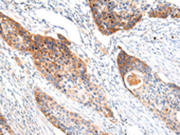 Rabbit Polyclonal Antibody to Lambda Light chain