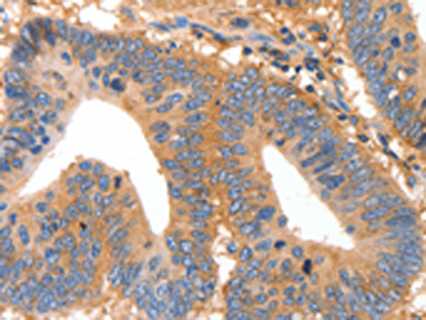 MUC6