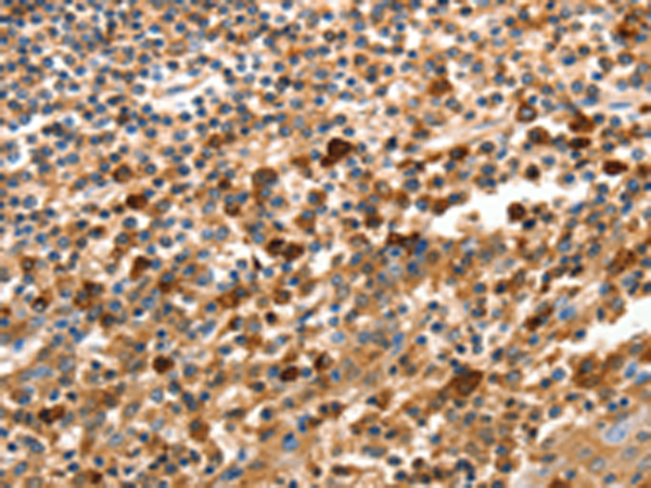 Rabbit Polyclonal Antibody to MUC6
