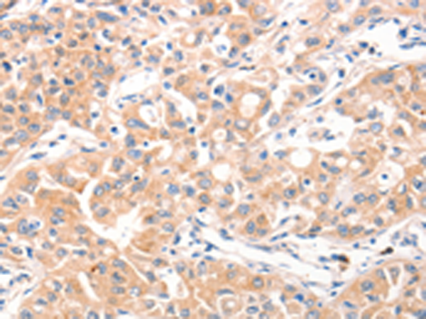 MUC2