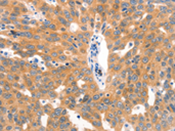 Rabbit Polyclonal Antibody to MUC2