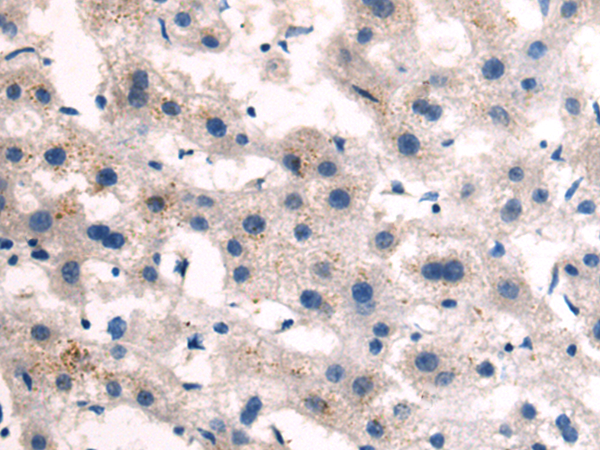 Rabbit Polyclonal Antibody to MUC5B