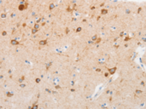 Rabbit Polyclonal Antibody to MUC13