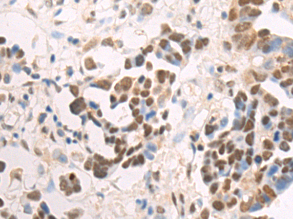 Rabbit Polyclonal Antibody to TRIM63