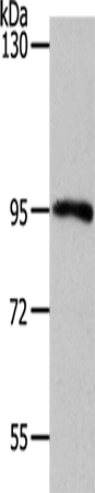 MYSM1
