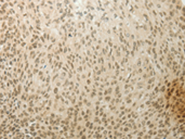 Rabbit Polyclonal Antibody to MYSM1