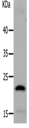 LCN2