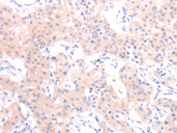 HCRT/pan Orexin 