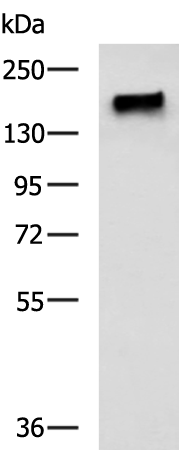 PALB2