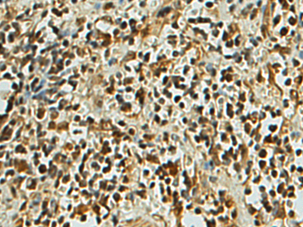 Rabbit Polyclonal Antibody to PALB2