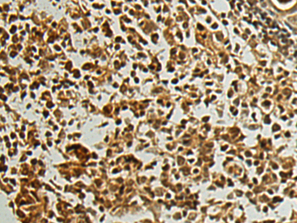 Rabbit Polyclonal Antibody to PALB2