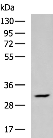 PSCA