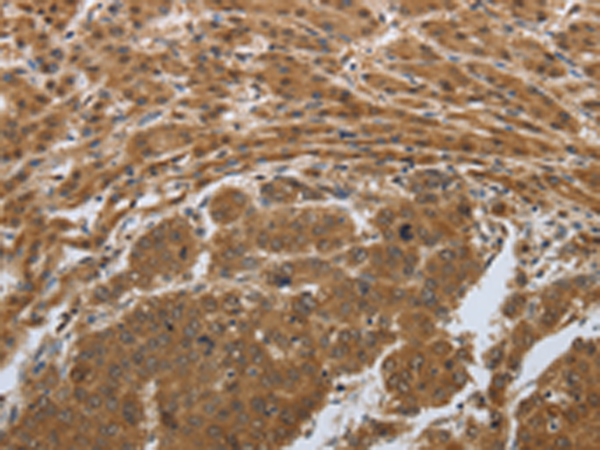 Rabbit Polyclonal Antibody to PSMD6