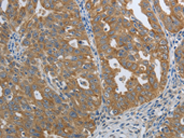 Rabbit Polyclonal Antibody to PTPRM