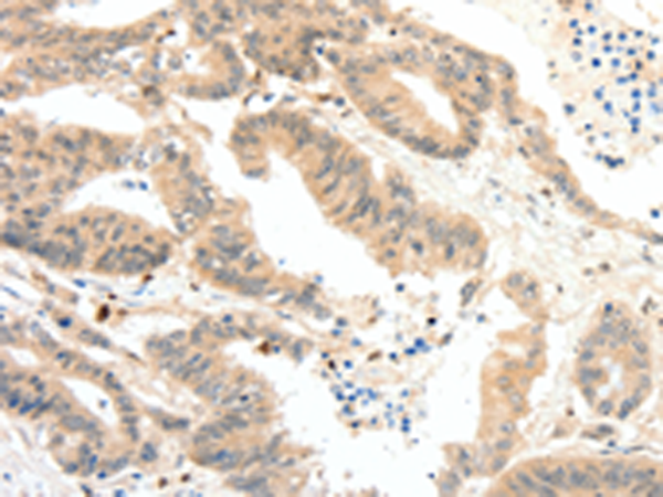 Rabbit Polyclonal Antibody to RRAD