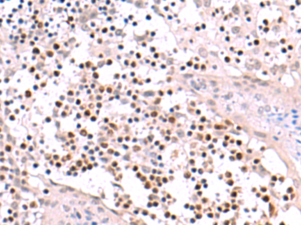 Rabbit Polyclonal Antibody to RUNX3