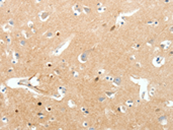 Rabbit Polyclonal Antibody to SCN9A