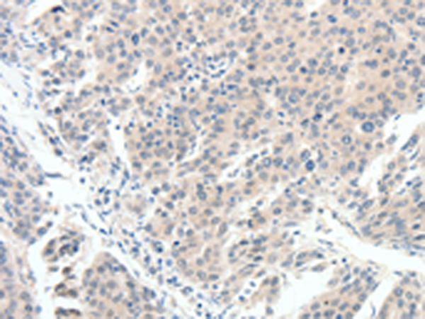 SCN10A