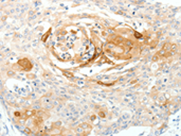 Rabbit Polyclonal Antibody to SCN10A