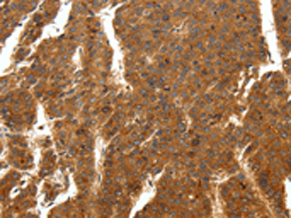 SCN11A