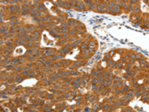 Rabbit Polyclonal Antibody to SCN11A
