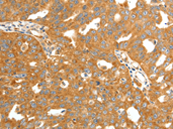 Rabbit Polyclonal Antibody to SCT