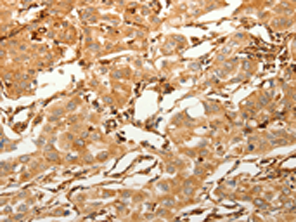 Rabbit Polyclonal Antibody to SFRP1