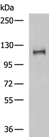 SLC24A1