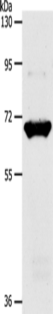 SLC33A1