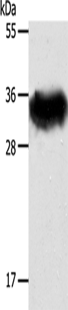 STX1A